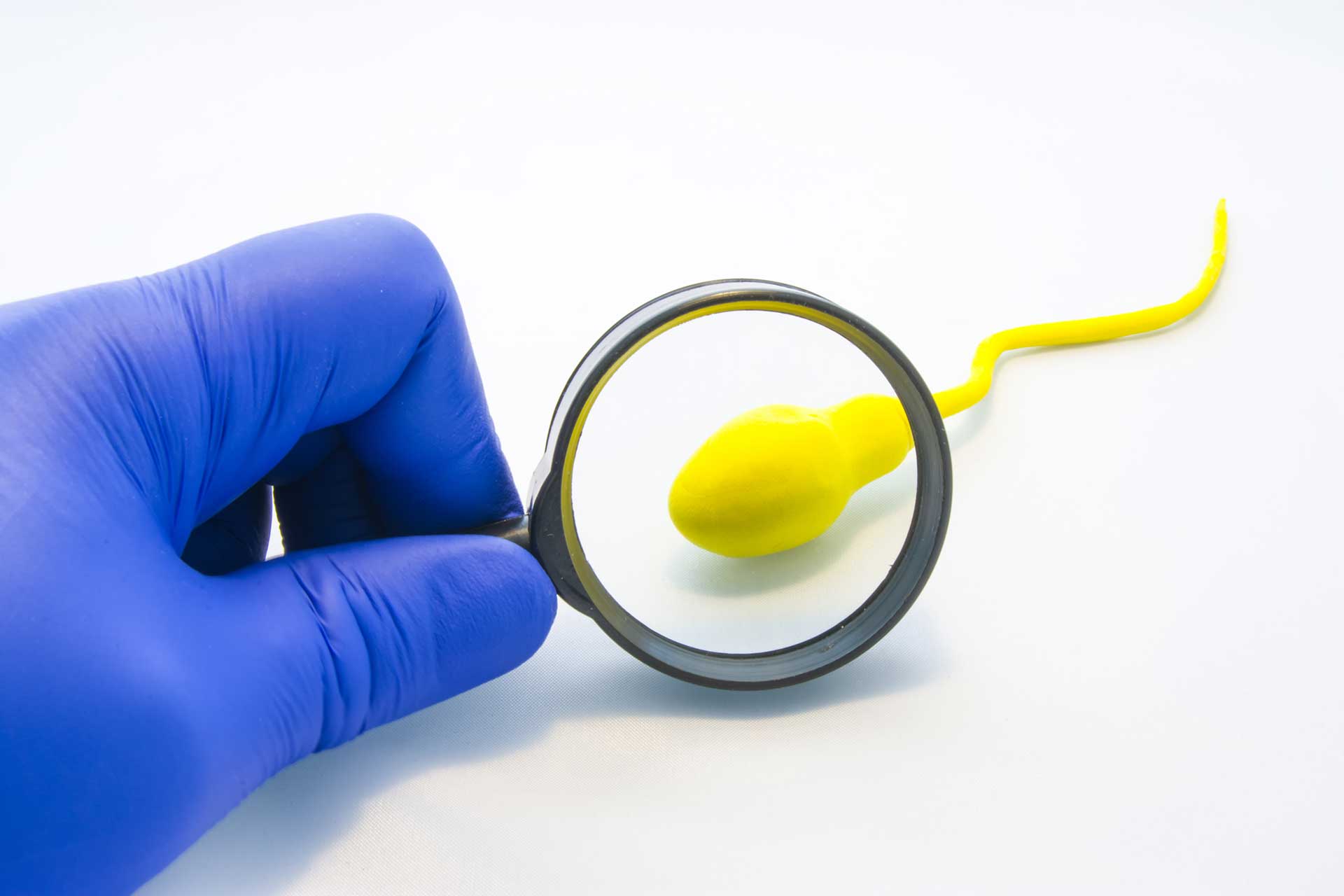 urologicum duisburg diagnostic-labor-spermiogramm