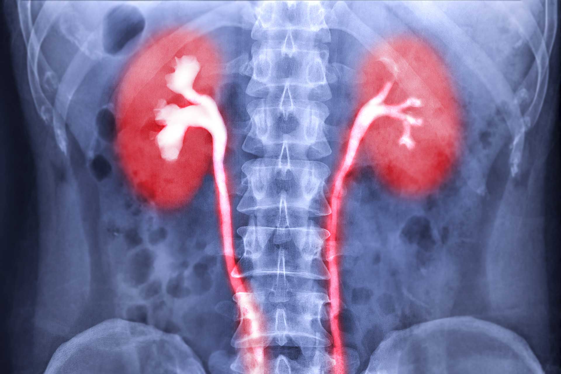 urologicum duisburg diagnostic labor-urinlabor